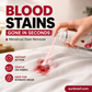 🔥Limited-Time Offer ✨️Buy 2 Get 1 Free! 👱‍♀️🩸 Quick Blood Stain Remover—Powerful Protease